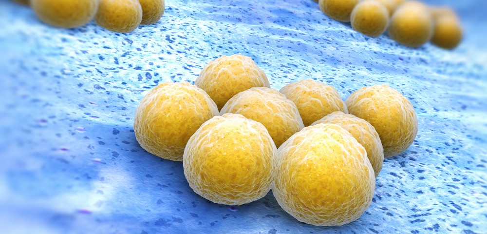 Resistant Staphylococcus aureus Causing Community-acquired Pneumonia Needs Novel Diagnostics Strategy, Study Shows